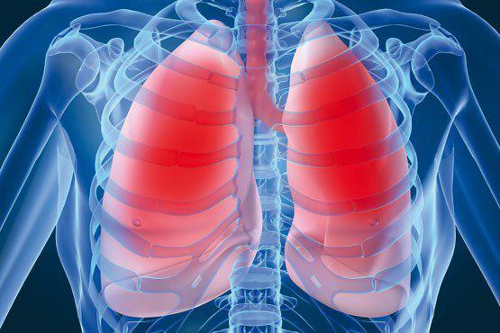 چگونه از عفونت های تنفسی در فصل زمستان پیشگیری کنیم