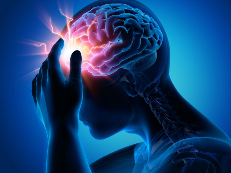 سکته مغزی در مردان چه علائمی دارد؟