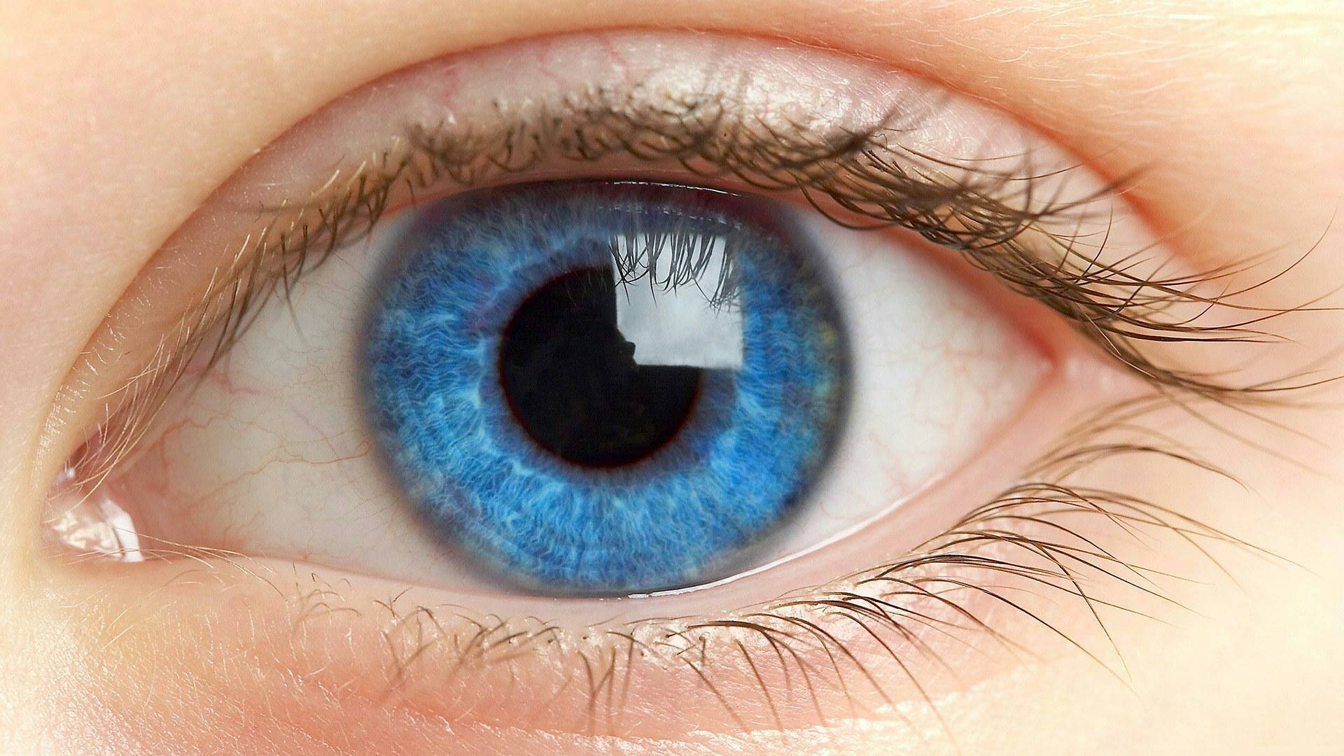 آیا خشکی چشم با میگرن ارتباط دارد؟