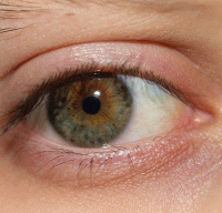 راه های درمان سندرم خشکی چشم