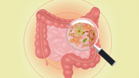  ارتباط باکتری های روده با افسردگی در افراد چاق