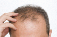 علت عمده ای که سبب ریزش مو می شود/ کمک به رشد بهتر مو با استفاده از کافئین