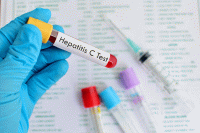 مبتلایان به هپاتیت c چی بخورند